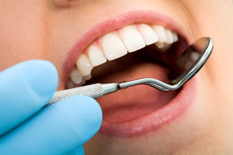 Closeup smile at the dentist with a mirror checking for oral cancer