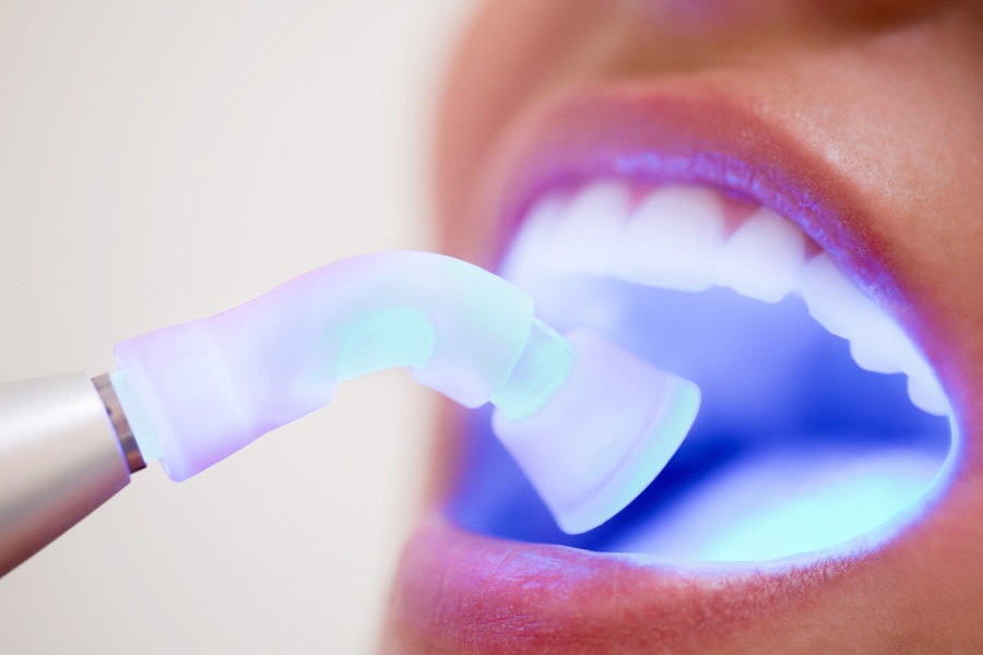 Closeup of a blue light tool inserted in an open mouth during an oral cancer screening