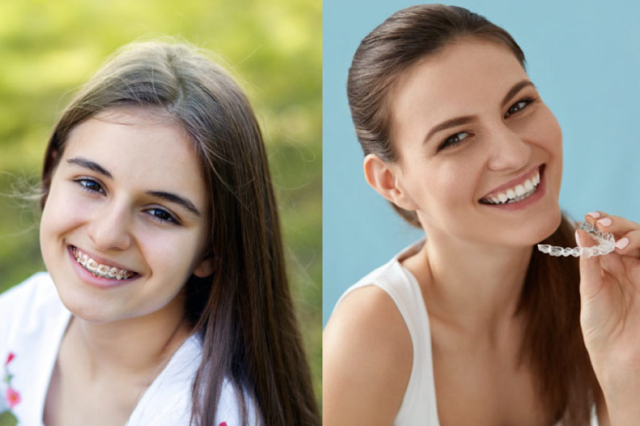 One teenage girl is wearing traditional braces and the other has Invisalign clear aligners.