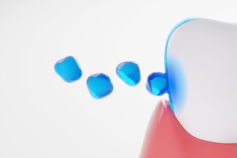 fluoride and adults for preventing cavities